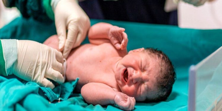 سزارین در ایران ۳ برابر استاندارد جهانی/ این استان صدرنشین جدول سزارین در ایران است